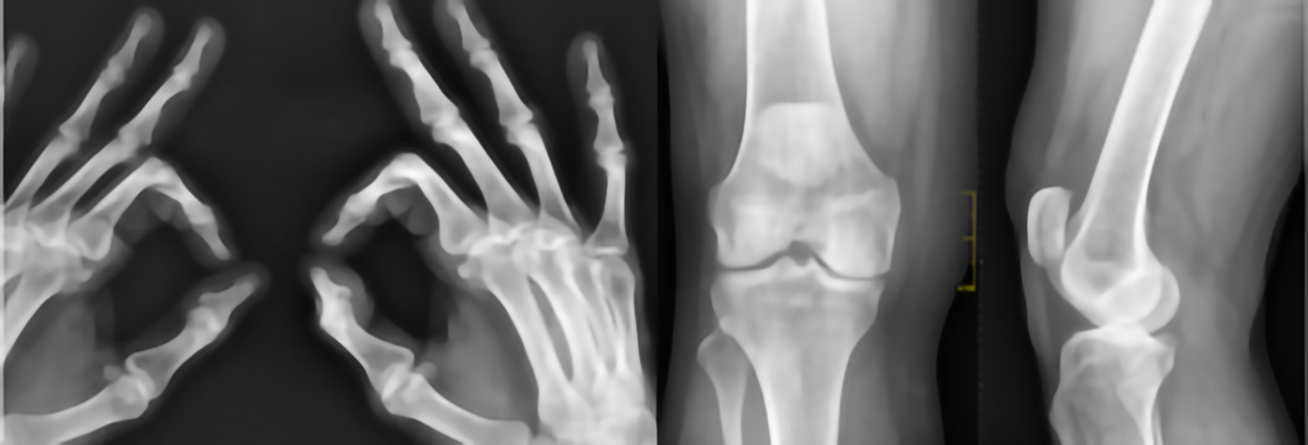 Diagnostica per immagini –                                                        Radiografie e RX domiciliare